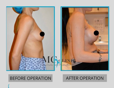 Slider image (4) MEHMET CEBER CLINIC